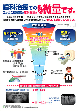 歯科治療でのX線検査放射線量